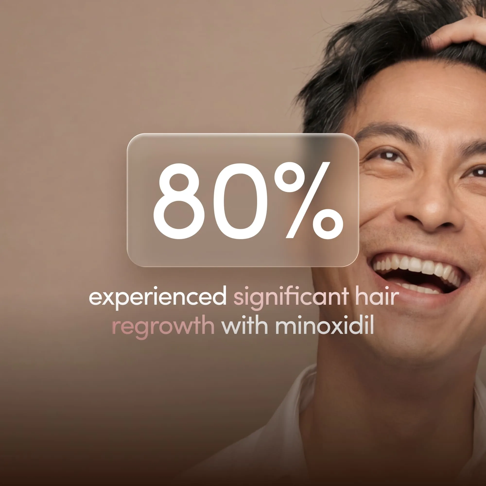 Finasteride + Minoxidil Blend
